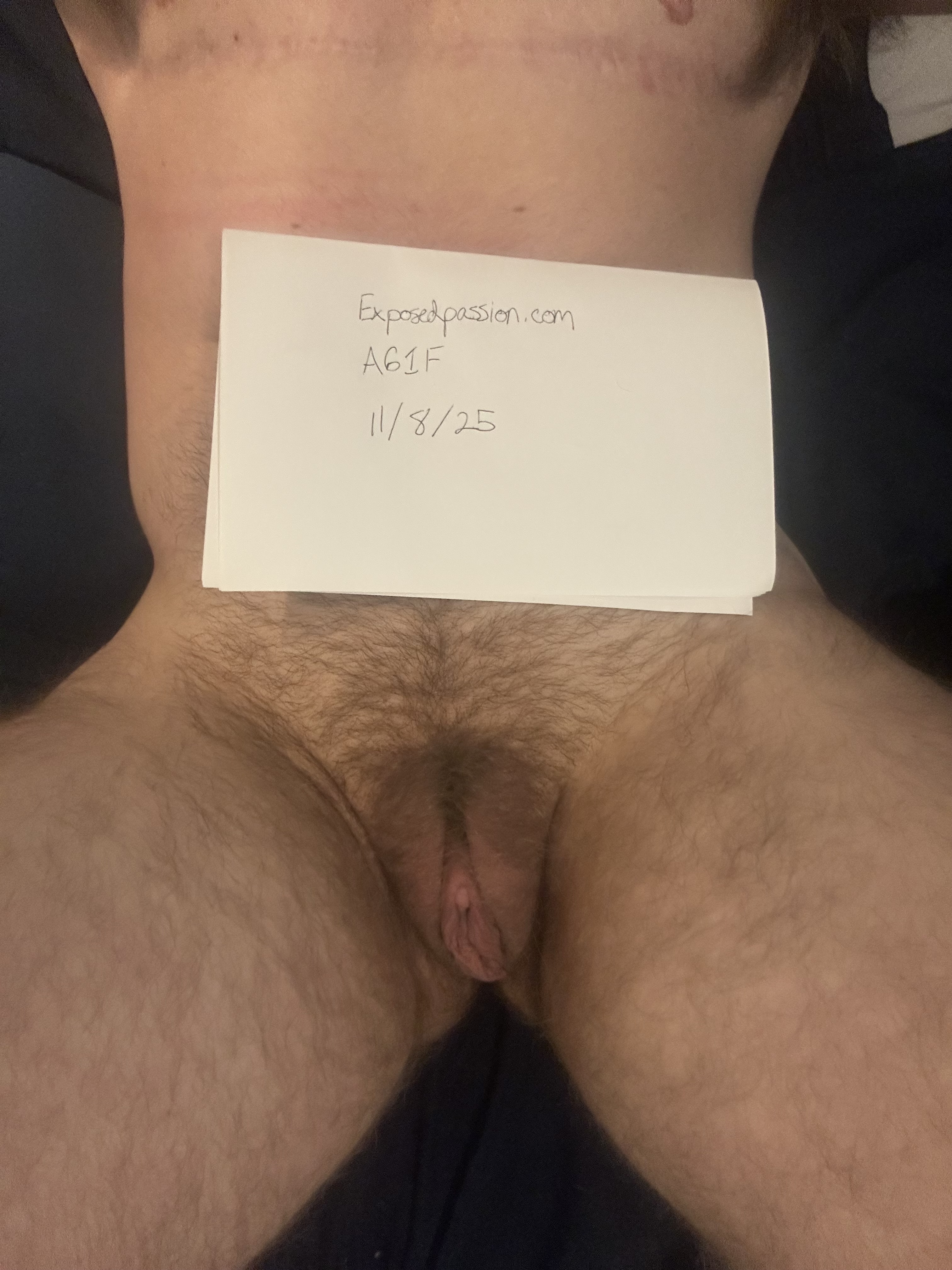 A61F-Verification