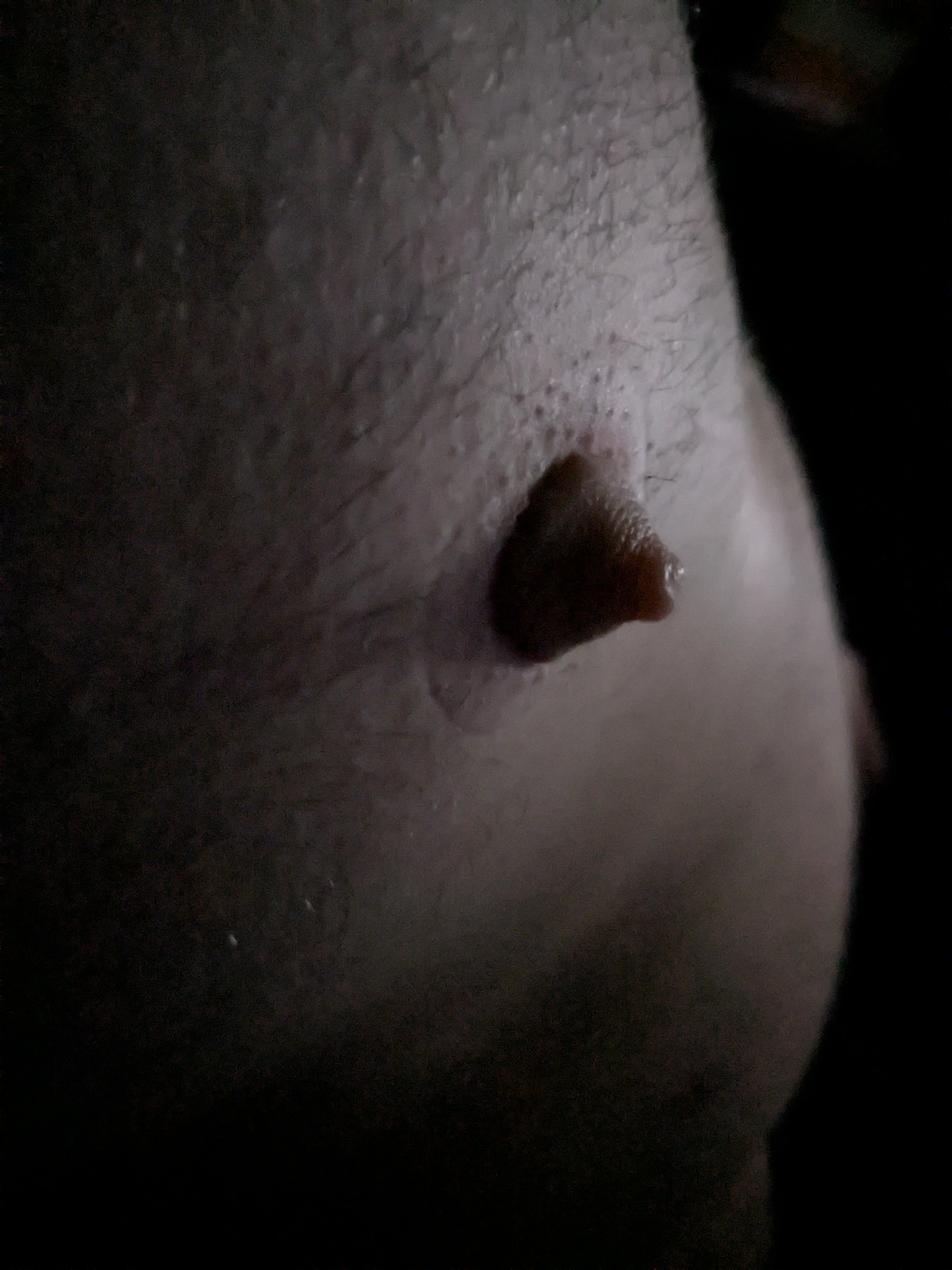 pumped nip