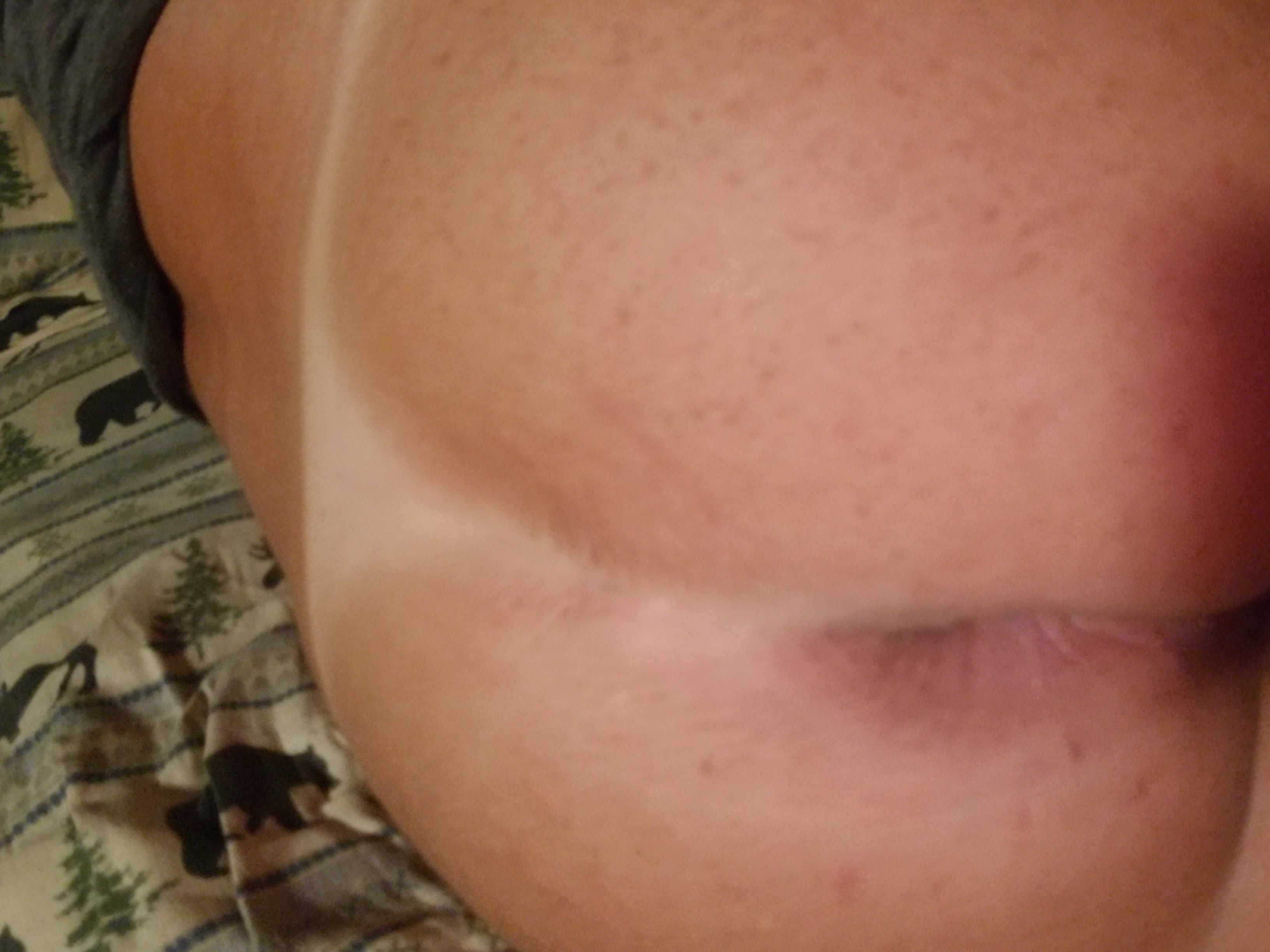 Butthole and tanline