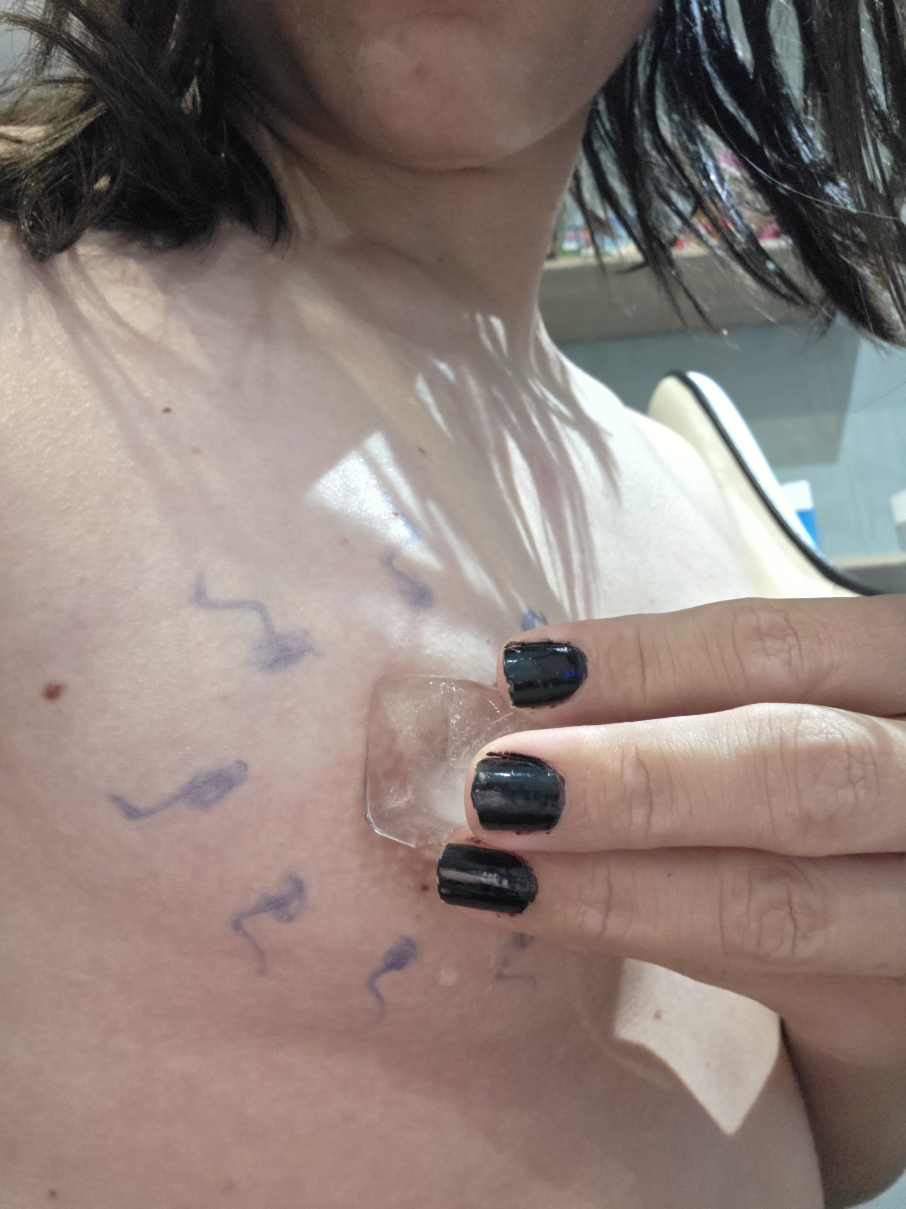 Sperm, hormones, and ice
