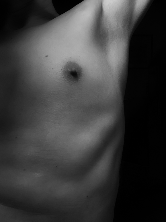 Breast