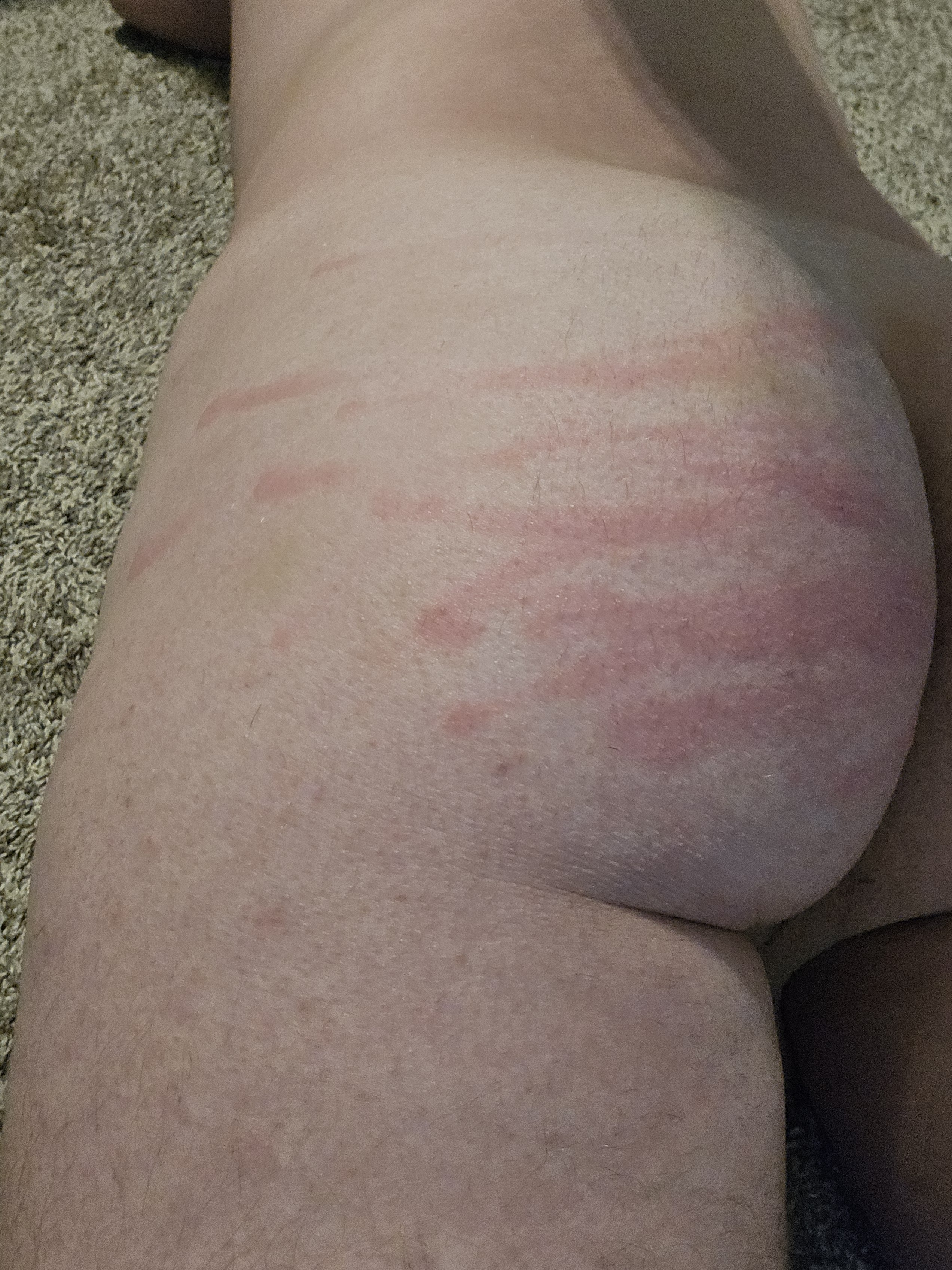 Whipped Ass