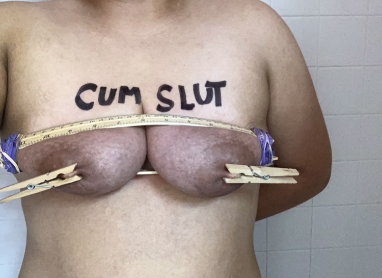Purple tits (pre-op)