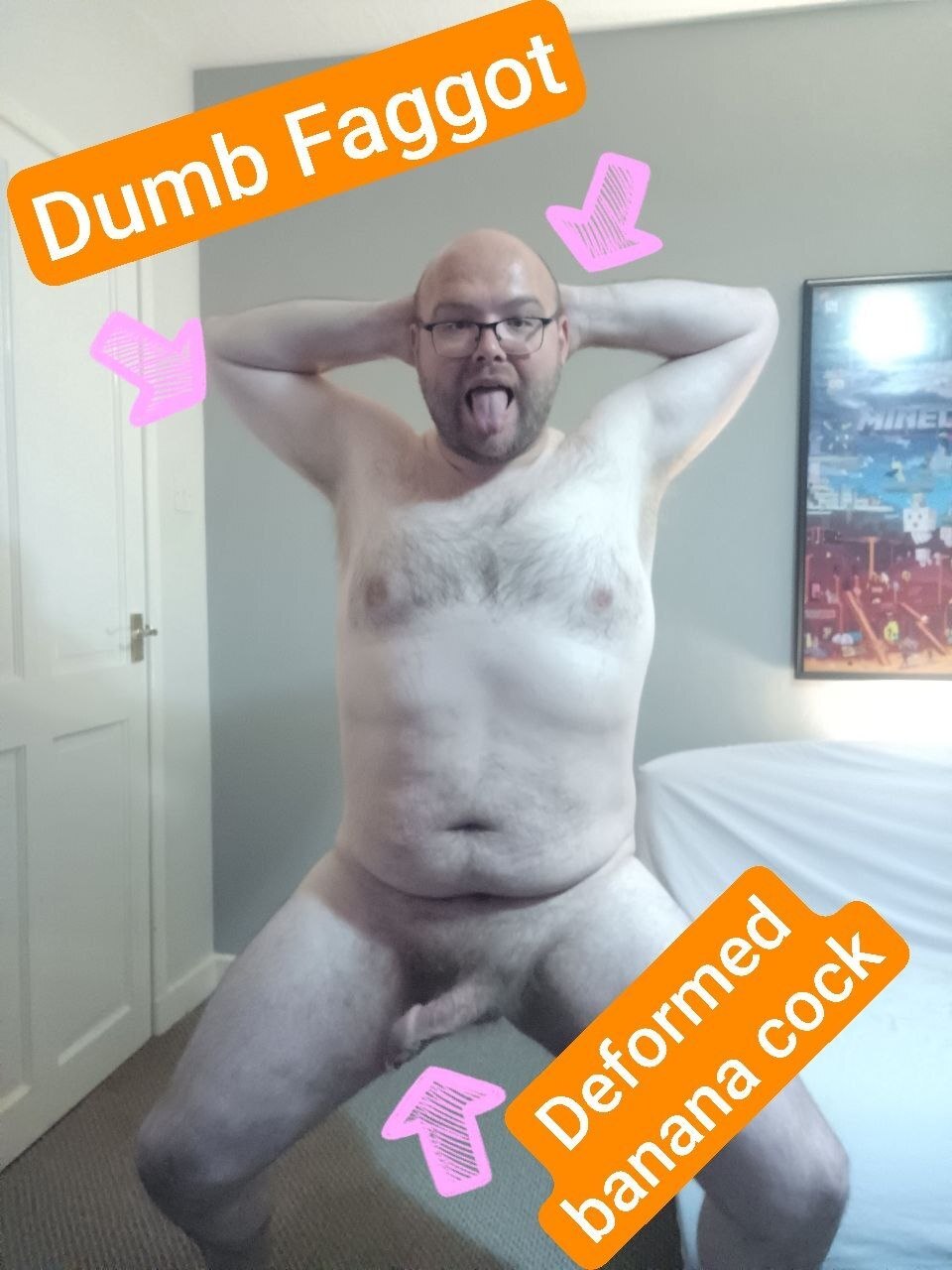 Roast Me For My Deformed Banana Cock!