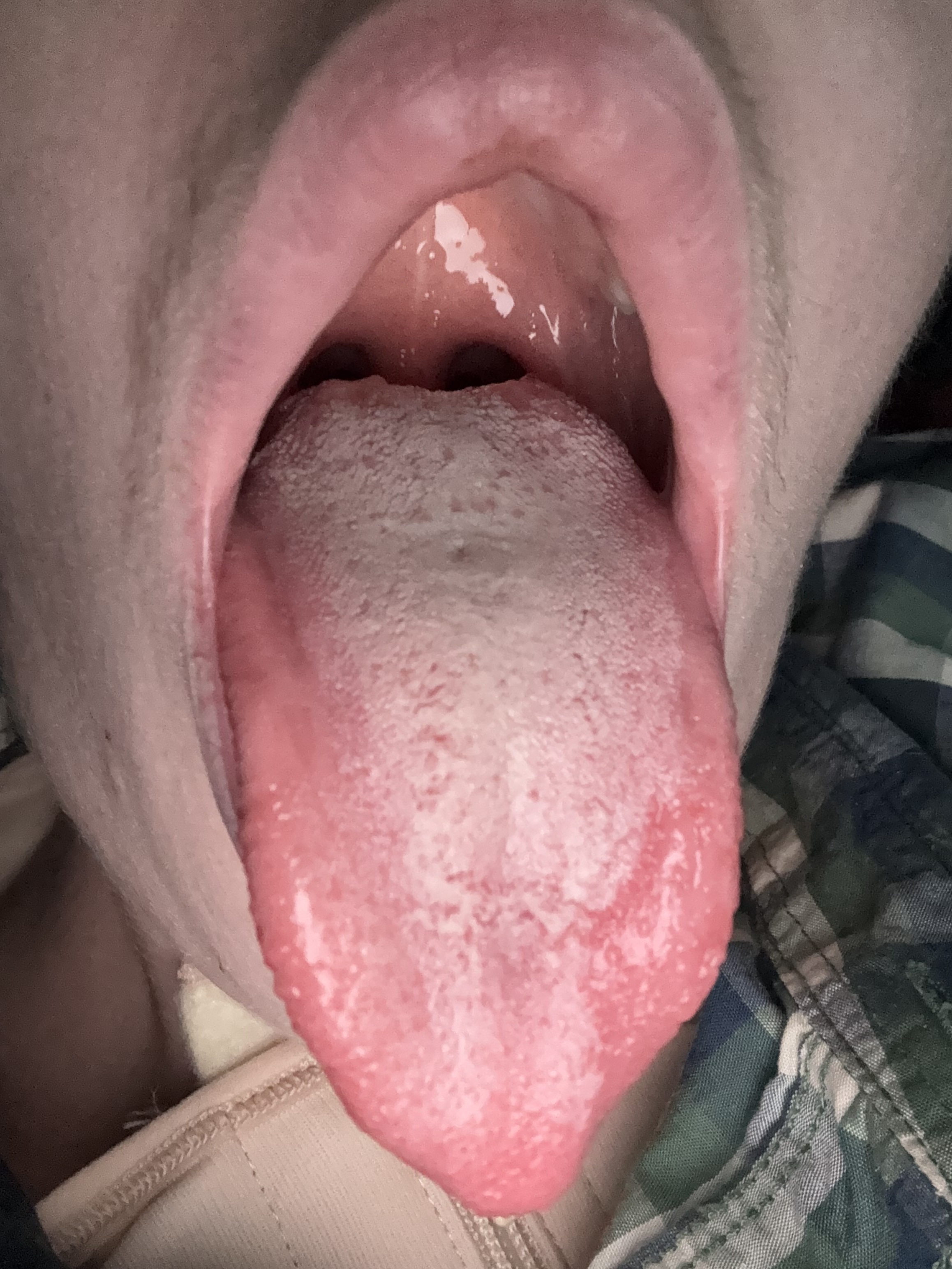 rpe my mouth