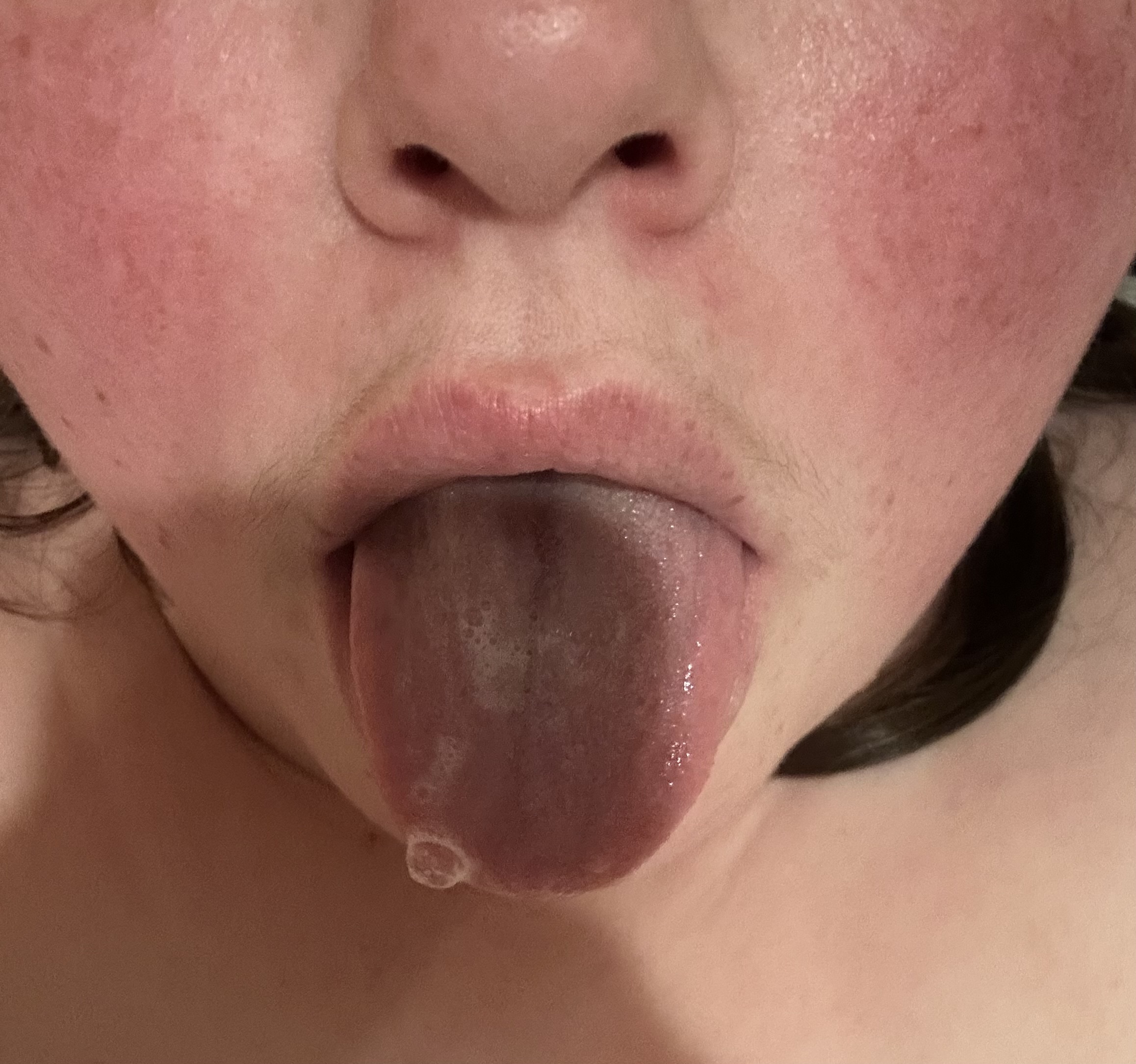 Drooling over exposure