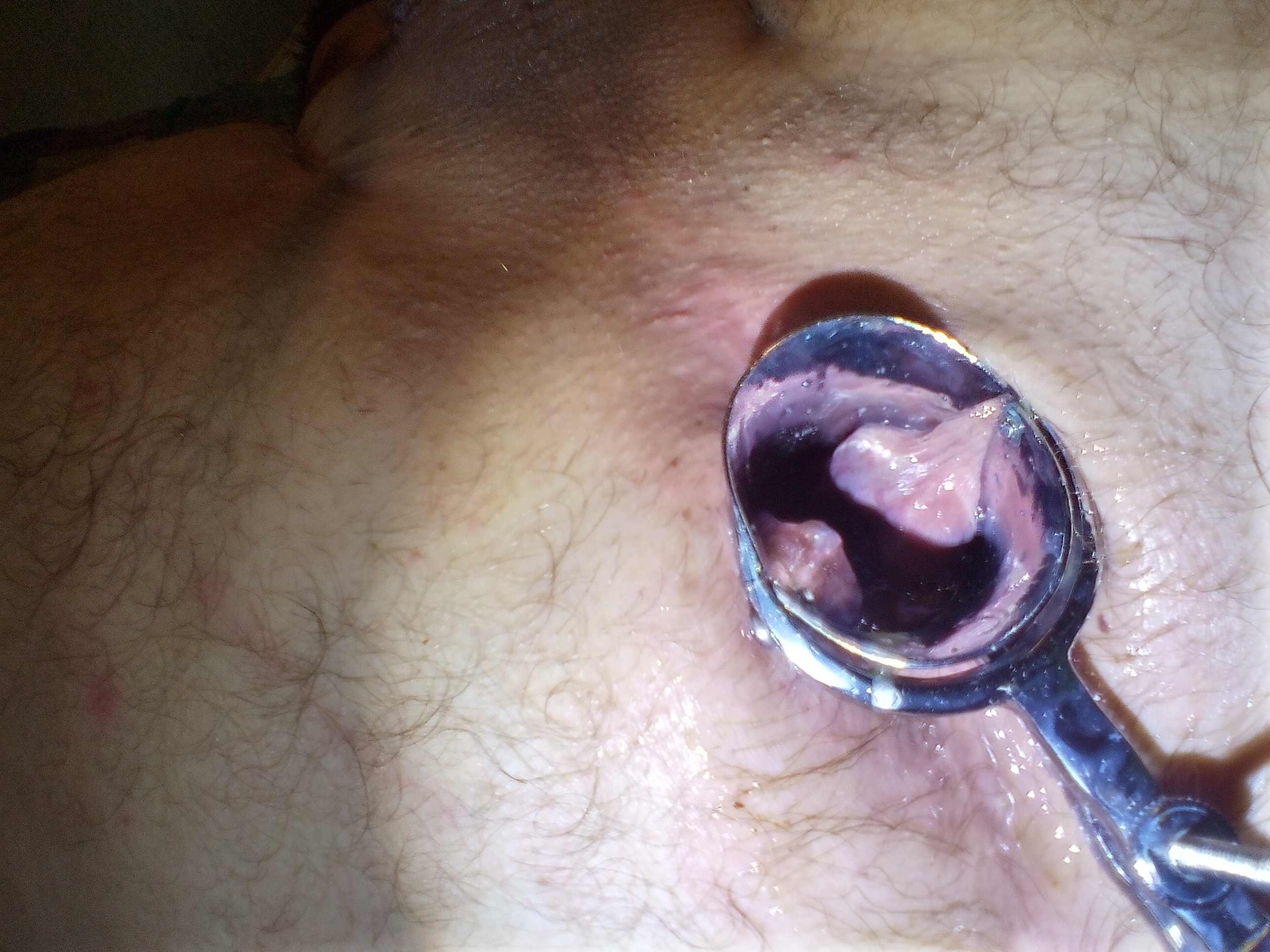 pig's open hole for Master to use