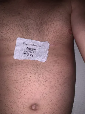 Verification