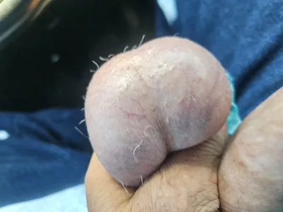 My balls