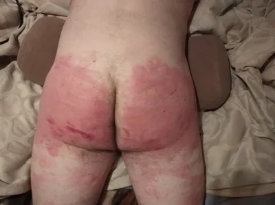 spank