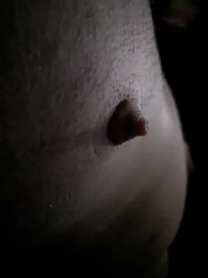 pumped nip