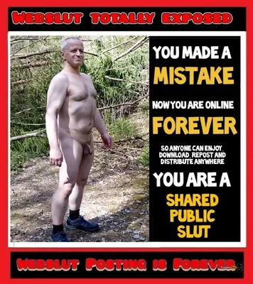 Exposed fag