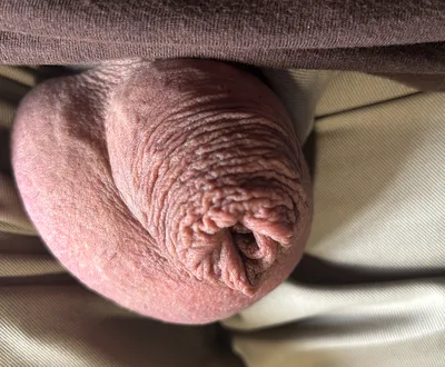 another clitty pic