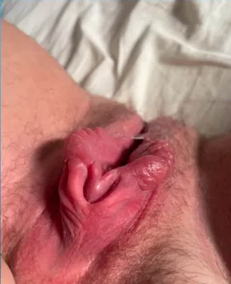Todays piggy cunny pic horny huge red and swollen