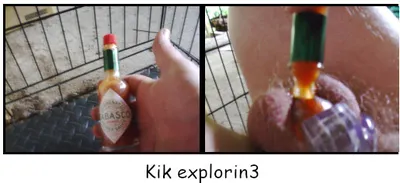 It Burns!