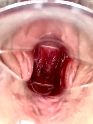 Free use cervix