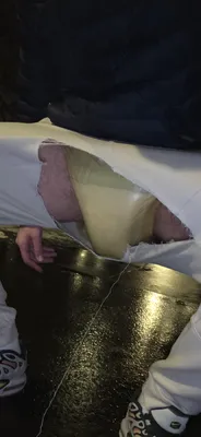 Exposed in the street