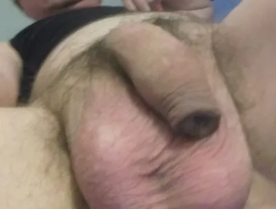 Small penis